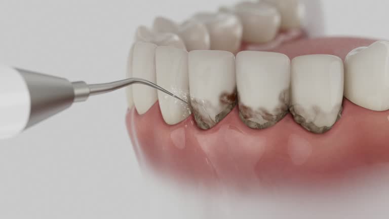 Reliable Dental Implants contractor in Keller, TX by Smile Center Dentistry